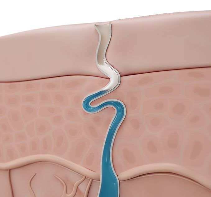 Is it dangerous to block sweat?